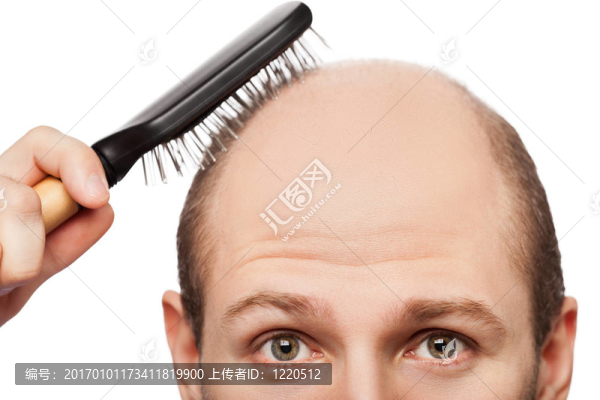 禿頭的男人的頭