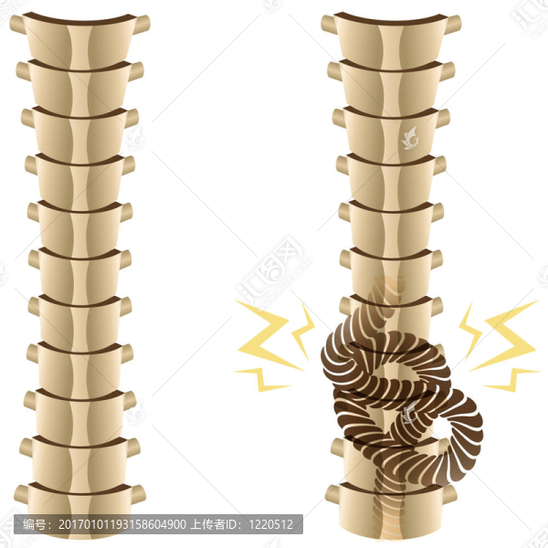 打結的脊柱