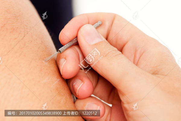 shonishin針?biāo)? title=