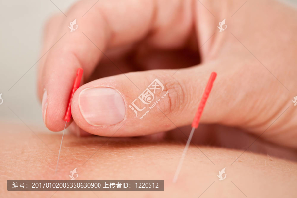 針灸的宏