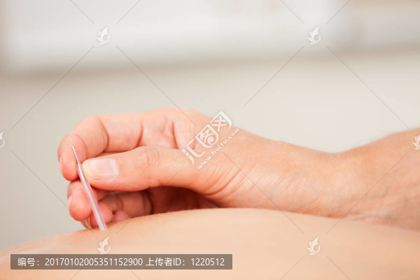 goshin針插入針