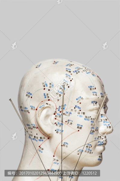 針灸針