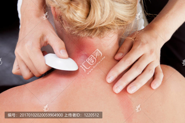 女人在接受刮痧治療頸