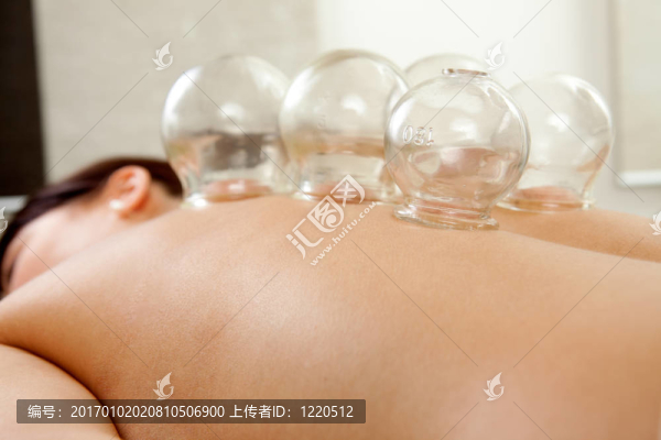 拔火罐
