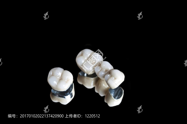 瓷冠