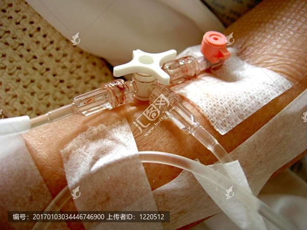 滴注生理鹽水