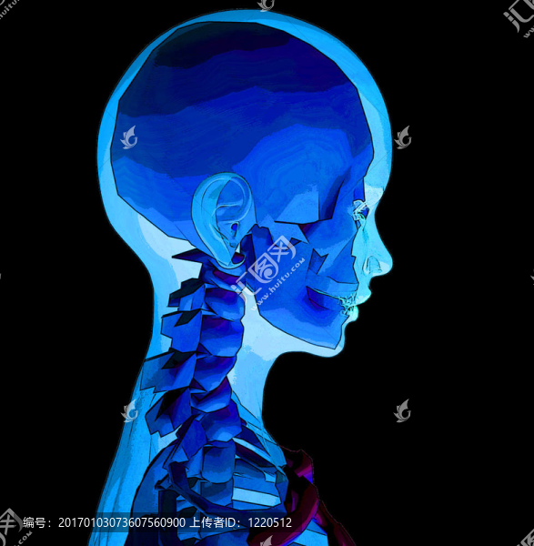 X,Ray,4