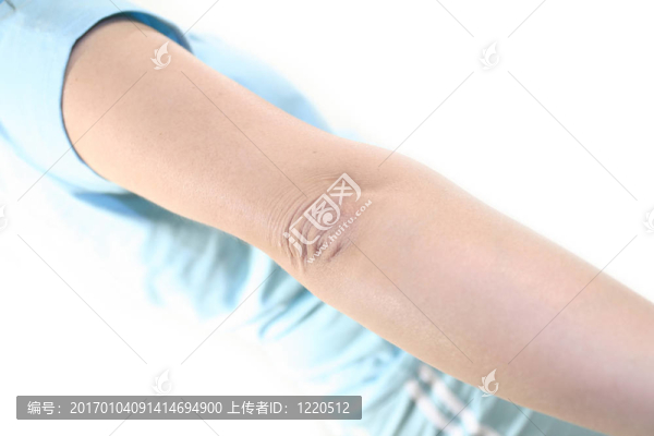 臂