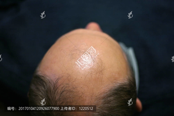 我的頭發(fā)在哪里2