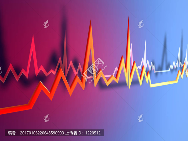 心電圖線1