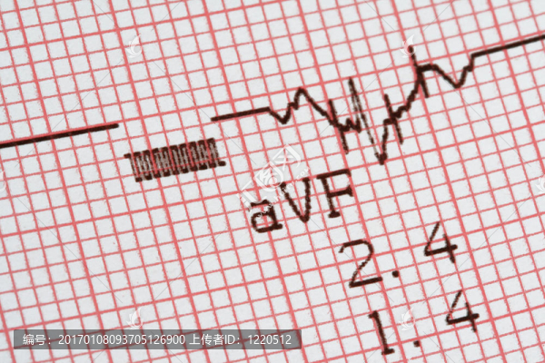 cardiographical測試結(jié)果