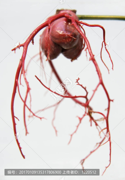 冠狀動(dòng)脈2-匯圖網(wǎng) www.fosd68.com 冠狀動(dòng)脈2