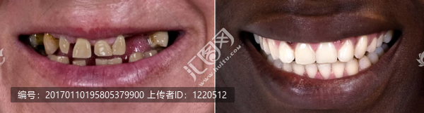 之前和之后