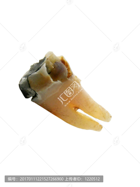 爛牙