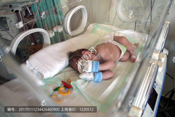 早產(chǎn)的嬰兒
