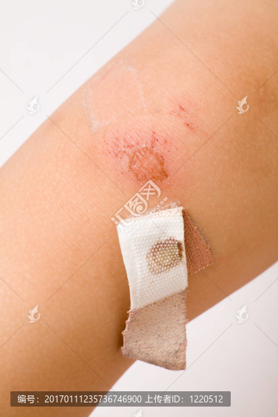 腿包扎繃帶-匯圖網(wǎng) www.fosd68.com 腿包扎繃帶