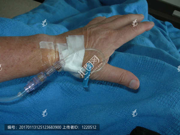 腕靜脈注射