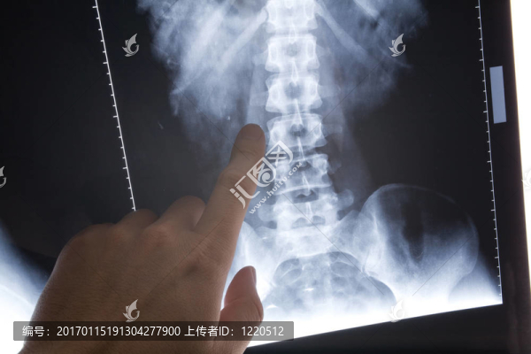 X射線圖像