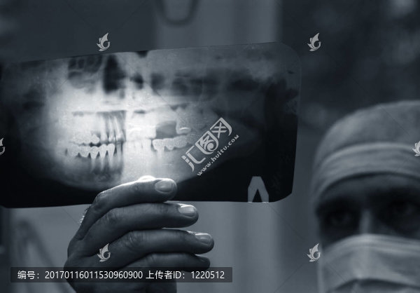 醫(yī)生用X射線