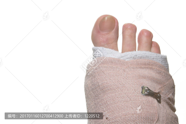 受傷的腳
