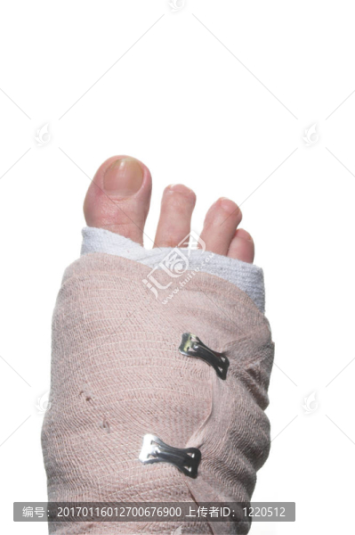 受傷的腳
