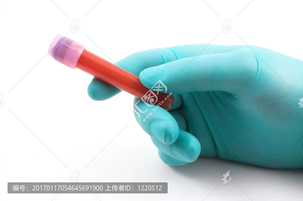 血液樣本