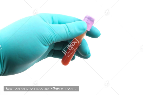 血液樣本