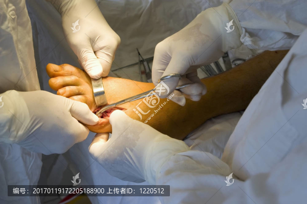 外科醫(yī)生團隊在工作