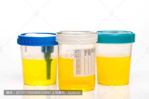 尿液樣本-匯圖網(wǎng) www.fosd68.com 尿液樣本