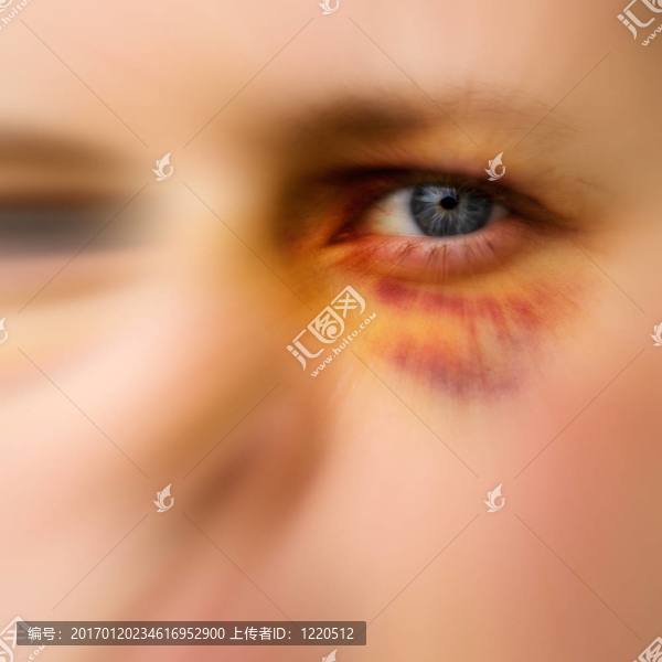 摘要黑眼圈