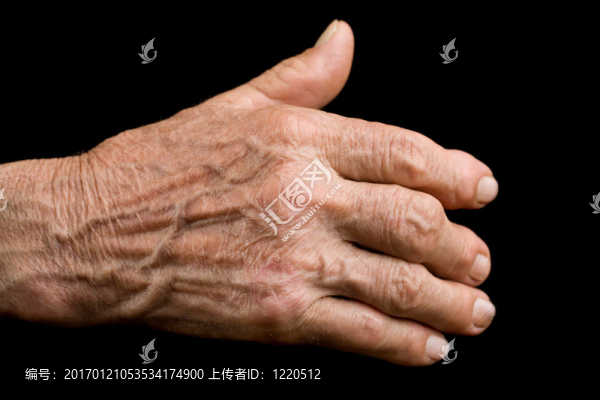 老年關(guān)節(jié)炎