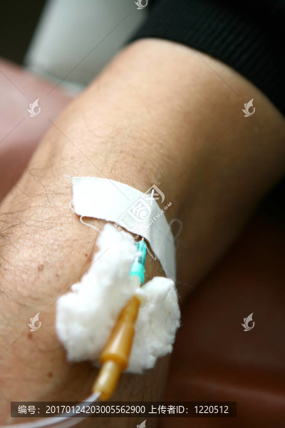 靜脈注射