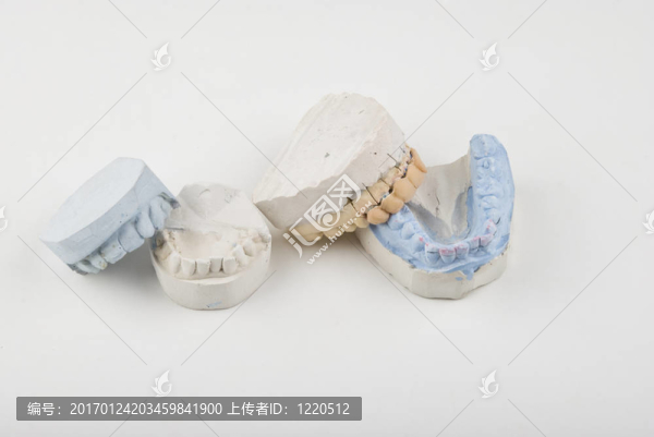牙模具