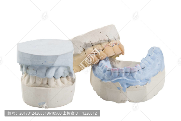 牙模具
