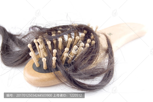 脫發(fā)問題