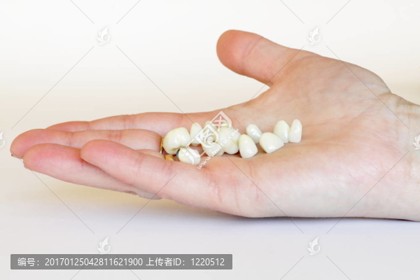 烤瓷冠；橋（牙）；牙板