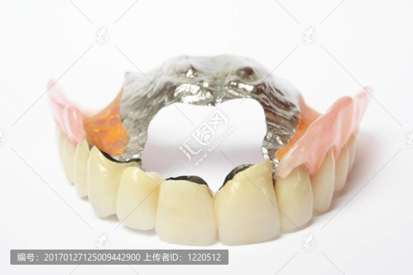 義齒；義齒；冠；橋