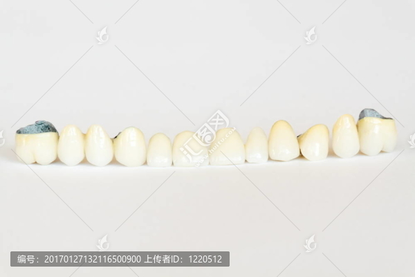 烤瓷冠（牙）；牙板；義齒