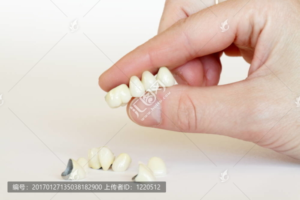 烤瓷冠；橋（牙）；牙板