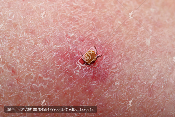 吸血鬼