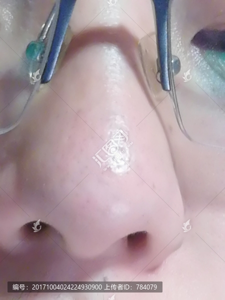 鼻子