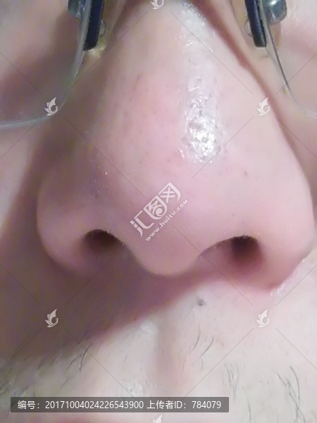 鼻子