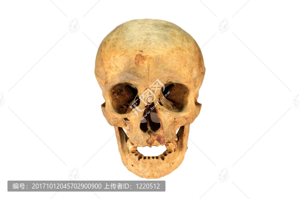 骷髏人