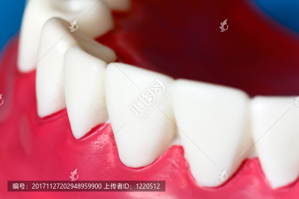 義齒