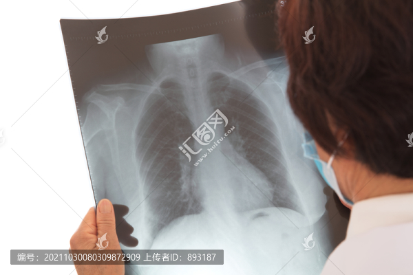 女醫(yī)生在認(rèn)真的查看肺部X光片