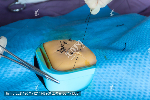 外科縫合