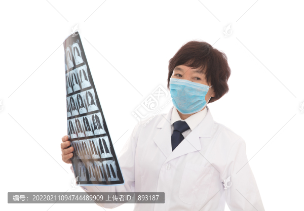專家在看肺部X光片