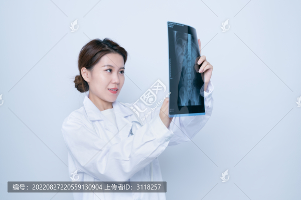 手持X光醫(yī)學(xué)照片的女醫(yī)生