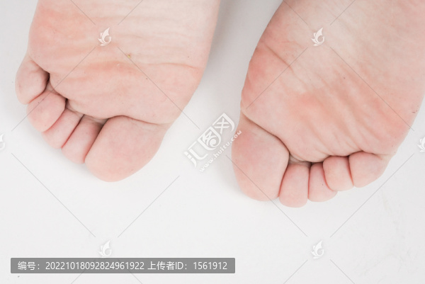 腳氣